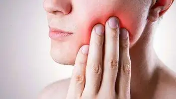 Symptoms of Salivary Glands